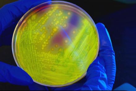 How overuse of antibiotics leads to drug-resistant superbugs: asset-mezzanine-16x9