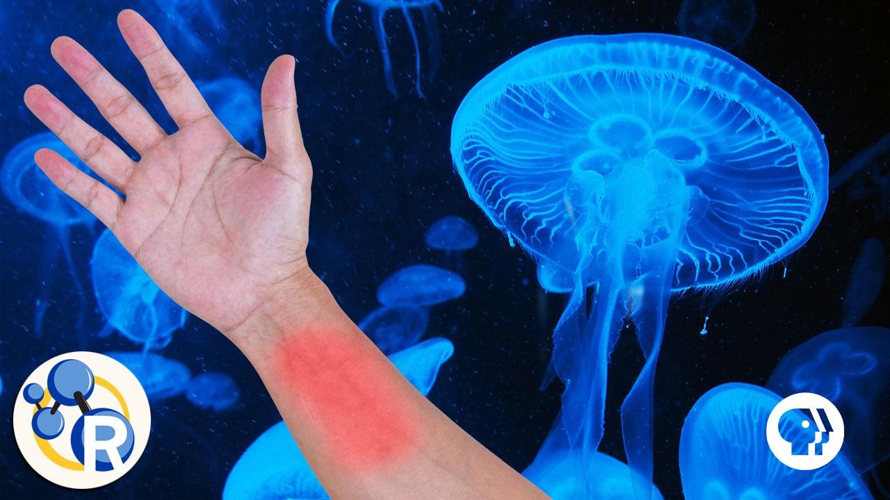 Does Peeing on a Jellyfish Sting Make it Stop Hurting? WETA