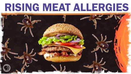 Could climate change make you allergic to meat?: asset-mezzanine-16x9