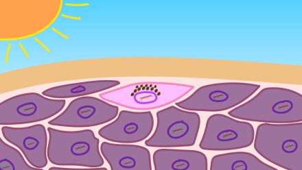 What Really Causes Sunburns?: asset-mezzanine-16x9