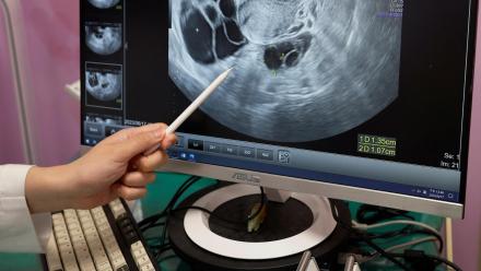 Egg freezing demand rises as more people delay parenthood: asset-mezzanine-16x9