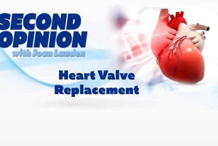Heart Valve Replacement: asset-mezzanine-16x9