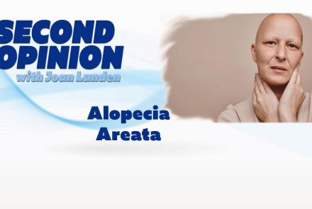 Alopecia Areata: asset-mezzanine-16x9