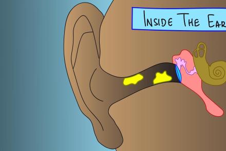 What Your Earwax Says About You: asset-mezzanine-16x9