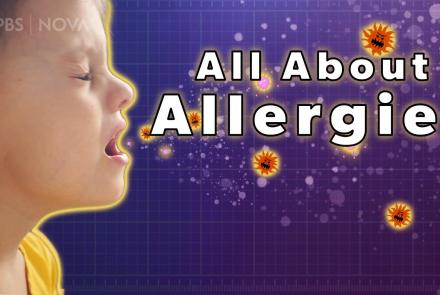 What are Allergies?: asset-mezzanine-16x9