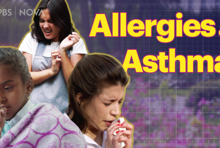 Understanding Allergies, Asthma, and Eczema: asset-mezzanine-16x9