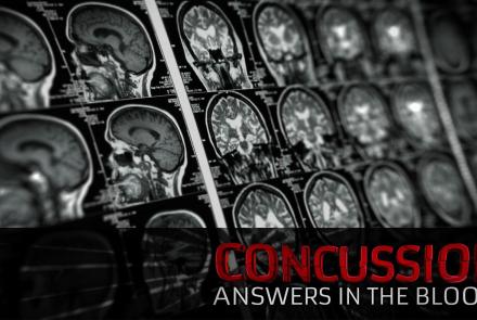 Concussion: Answers in the Blood?: asset-mezzanine-16x9